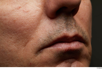  HD Face Skin Benito Romero cheek face lips mouth nose scar skin pores skin texture 0001.jpg